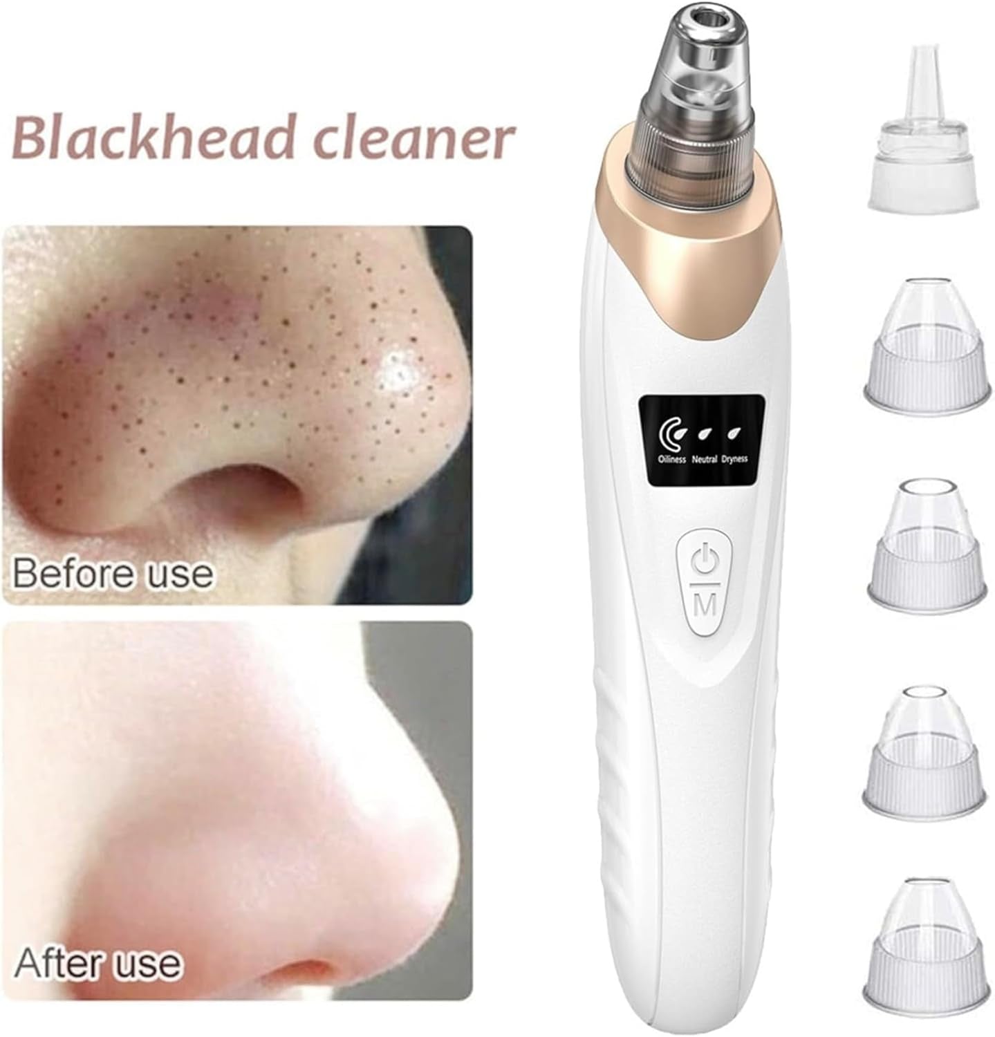 Faker Blackhead Remover