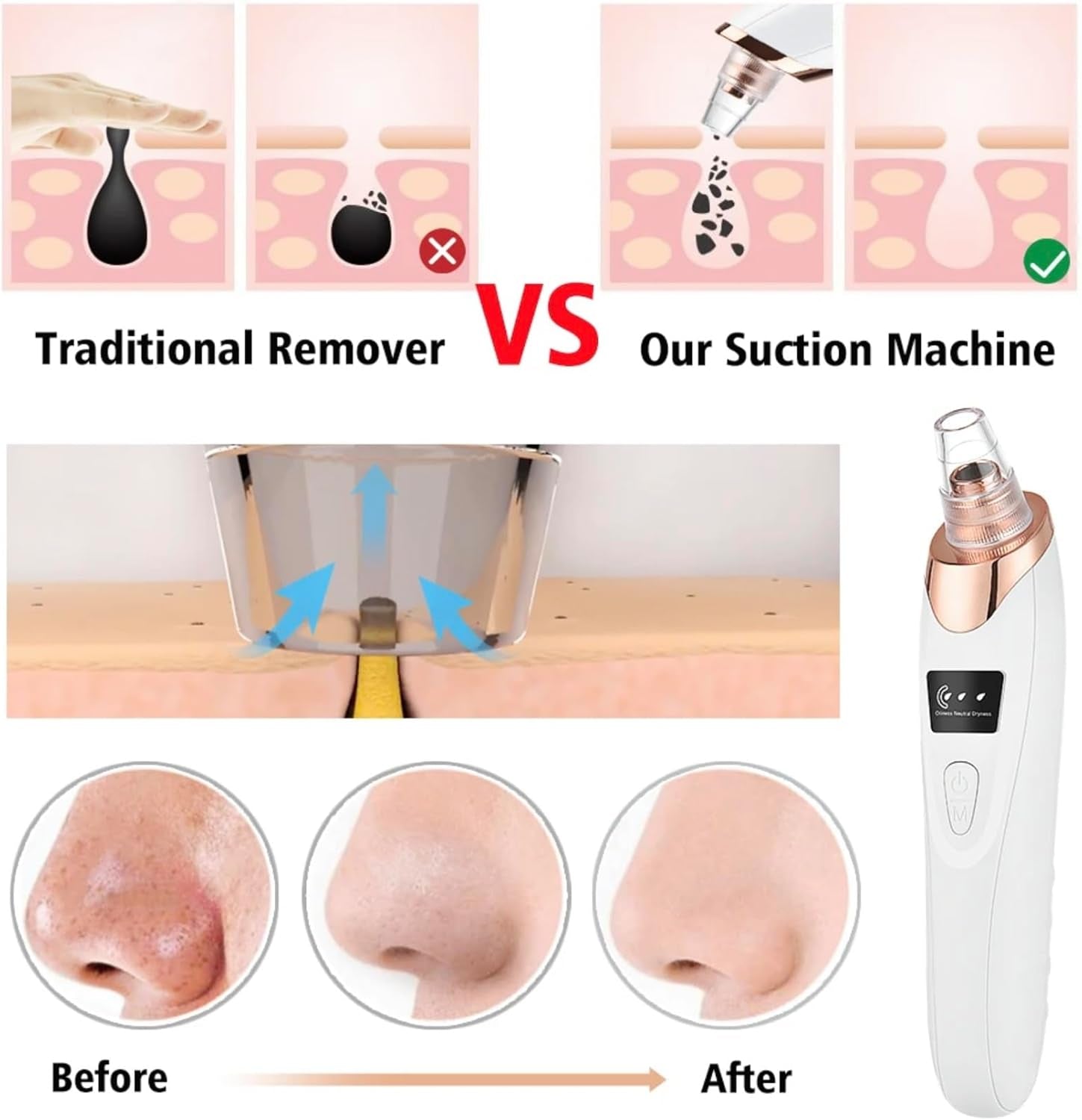Faker Blackhead Remover